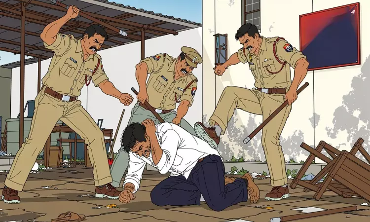 मजिस्ट्रेट कस्टडी में हुई मौत के लिए ज़िम्मेदार लोगों का नाम बता सकते हैं, CrPC की धारा 176(1A) के तहत FIR दर्ज करने का निर्देश दे सकते हैं: मध्य प्रदेश हाईकोर्ट मजिस्ट्रेट कस्टडी में हुई मौत के लिए ज़िम्मेदार लोगों का नाम बता सकते हैं, CrPC की धारा 176(1A) के तहत FIR दर्ज करने का निर्देश दे सकते हैं: मध्य प्रदेश हाईकोर्ट